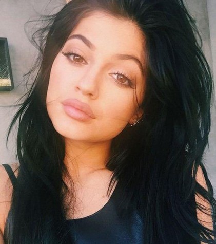 kylie-jenners-rumored-lip-injections-spark-talk